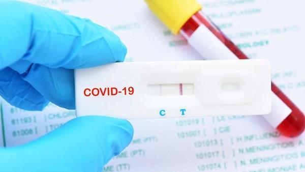 ABD’de evde ücretsiz Covid-19 testi dönemi başlıyor!
