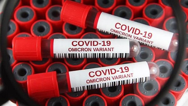 Günlük vaka sayısı iki buçuk ay sonra yeniden 30 binin üzerinde