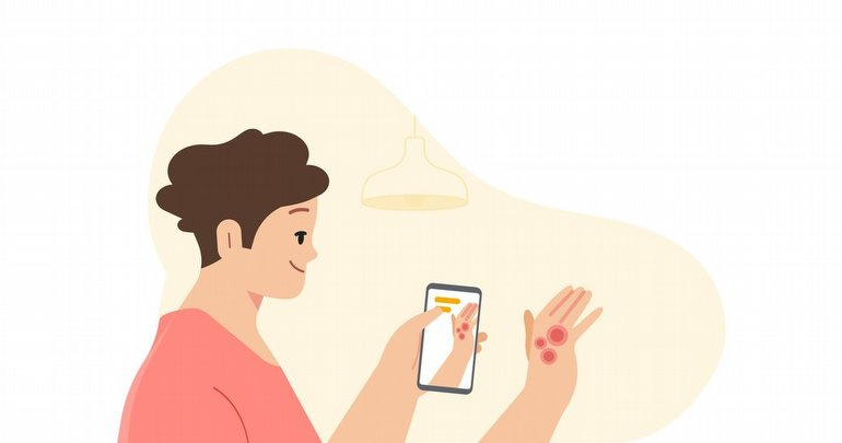 Google’dan, Cilt Sorunlarına Yapay Zeka Destekli Çözüm